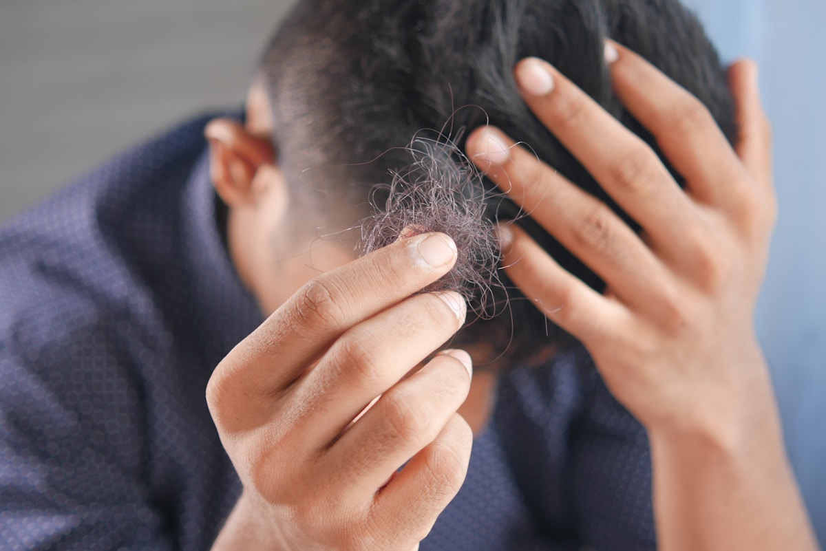 Caída del cabello en hombres: causas y soluciones reales